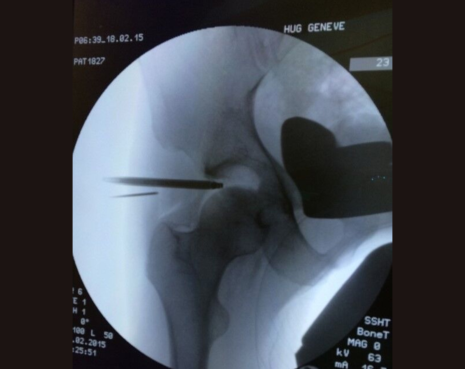 hip arthroscopy surgeon